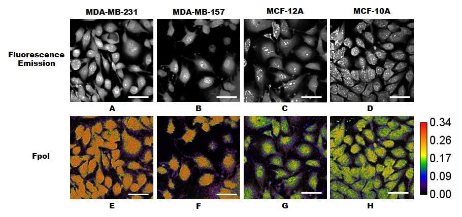 A. N. Yaroslavsky, X. Feng, A. Muzikansky and M. R. Hamblin, “Fluorescence polarization of methylene blue as a quantitative marker of breast cancer at the cellular level,” Sci. Rep. 9, 940 (2019).