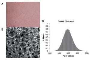 X. Feng, R. Patel and A. N. Yaroslavsky, "Wavelength optimized cross‐polarized wide‐field imaging for noninvasive and rapid evaluation of dermal structures," J. Biophoton 8(1), 324-331 (2015)